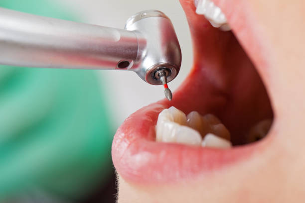 Best Knocked-Out Tooth Emergency  in Reedsburg, WI